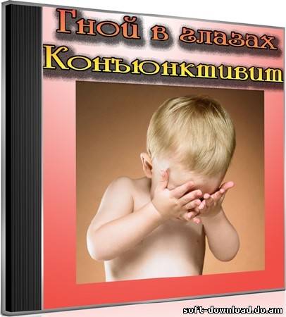 Гной в глазах. Конъюнктивит (2012) DVDRip
